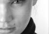 Image of woman looking straight on for dark under eye circles, bags and tear trough page