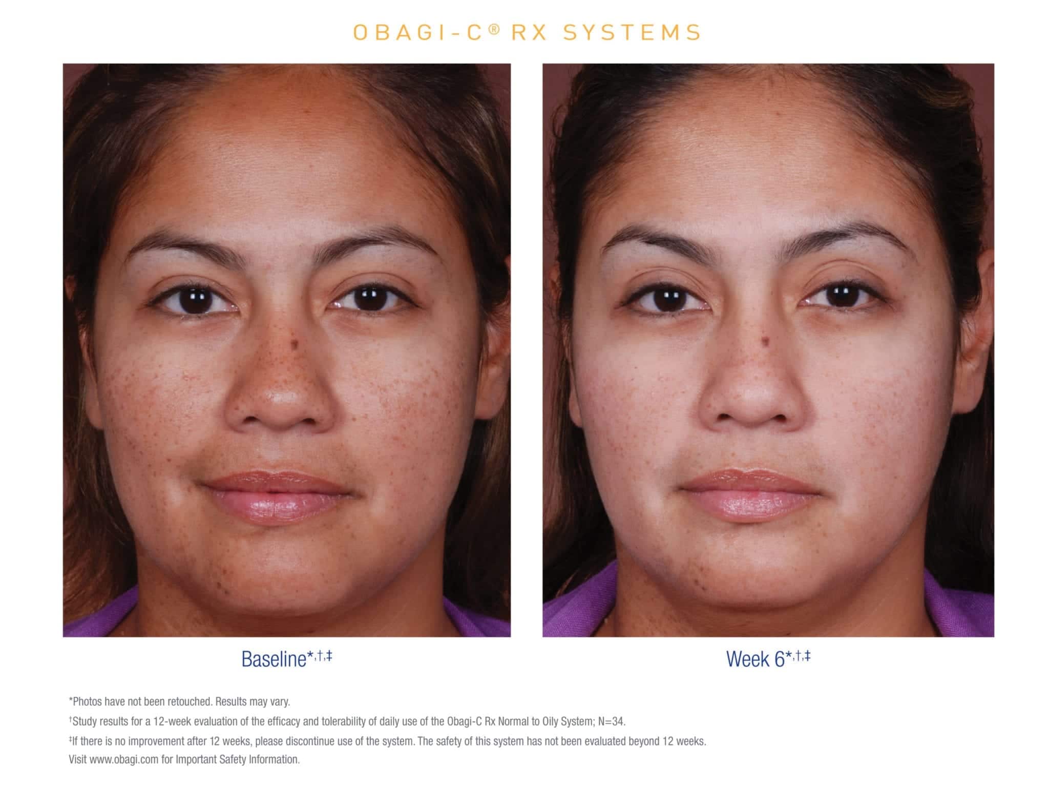 Obagi Skincare Online Shop Nu Derm, ClenziDERM, ObagiC & Tretinoin