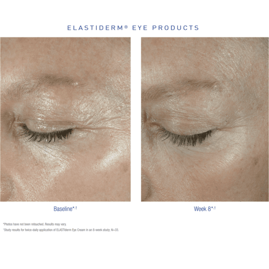 Obagi ELASTIderm Eye Cream before and after