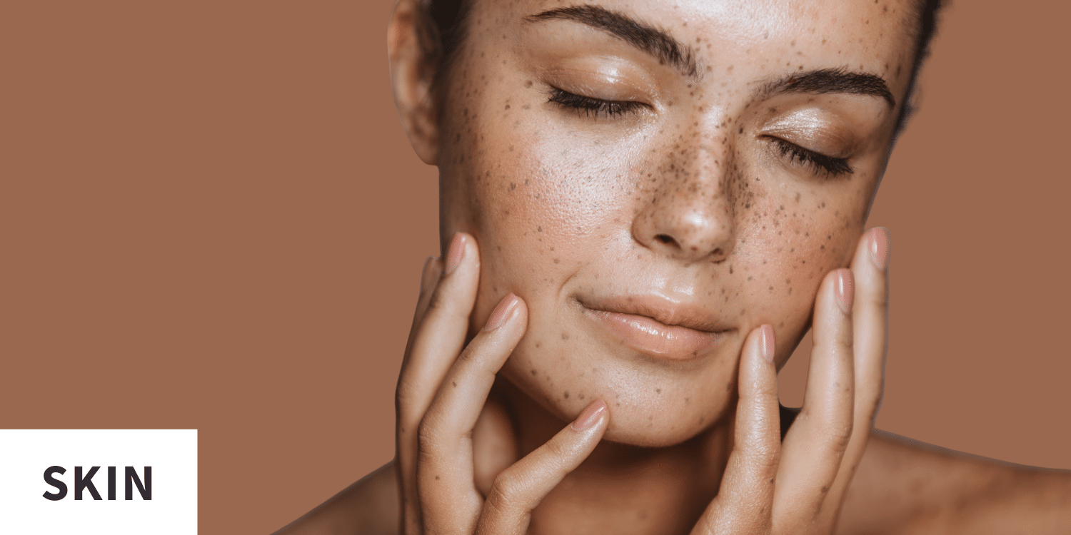 Tranexamic Acid Skin Care, Does It Work For Hyperpigmentation? Tranexamic Acid Skin Care, Does It Work For Hyperpigmentation?