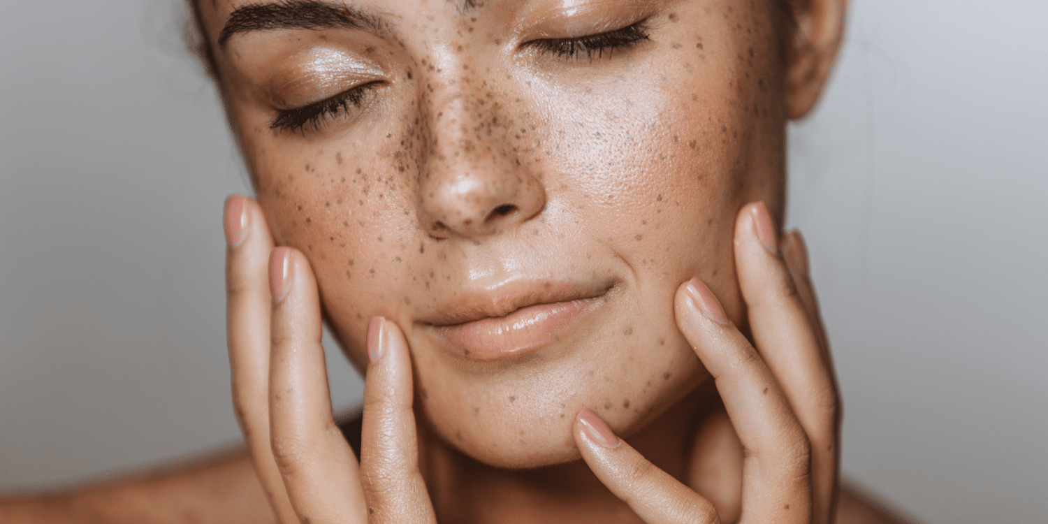 Tranexamic Acid Skin Care, Does It Work For Hyperpigmentation?